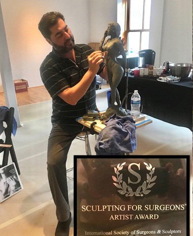 Dr. Mowlavi sculpting - Liposuction consult