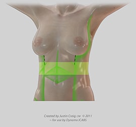 liposuction complications abdomen