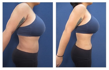 Waistline-26