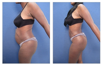 Waistline-28